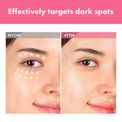 Arbutin 7% + Tranexamic Acid 4% Cream